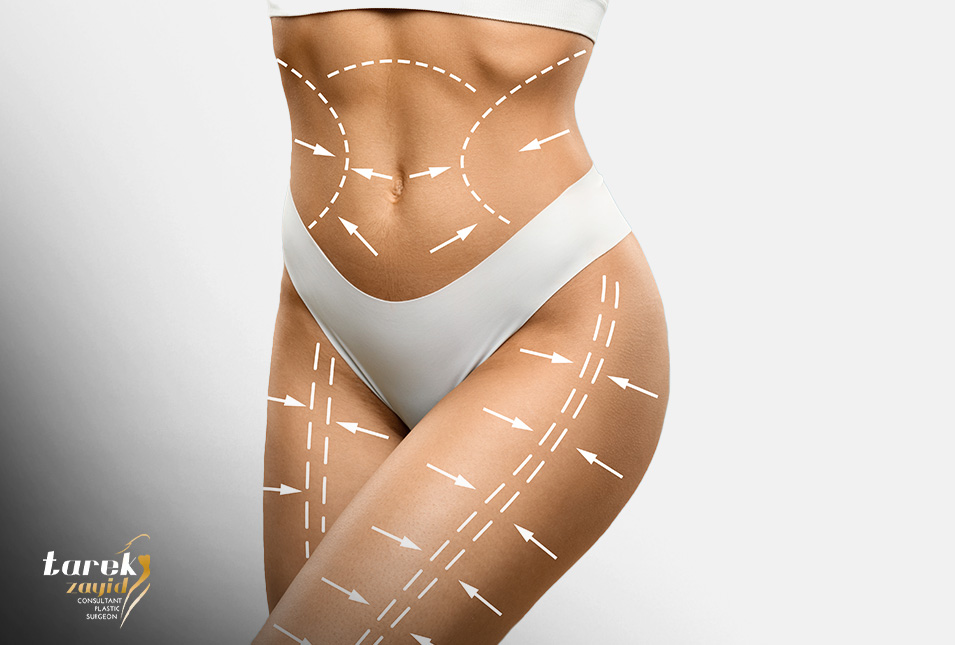 lipo