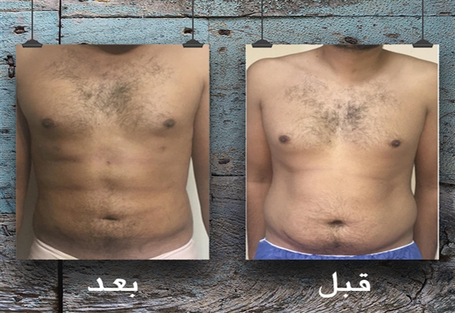 نحت الجسم رباعي الأبعاد و ال 6 Packs