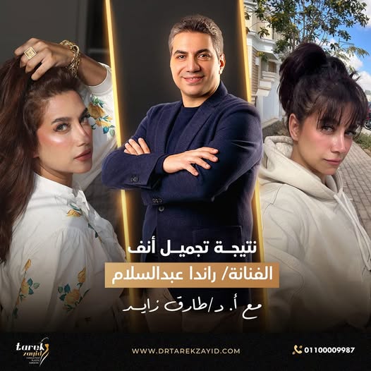 أسئلة-حول-تجميل-الأنف-قبل-وبعد2